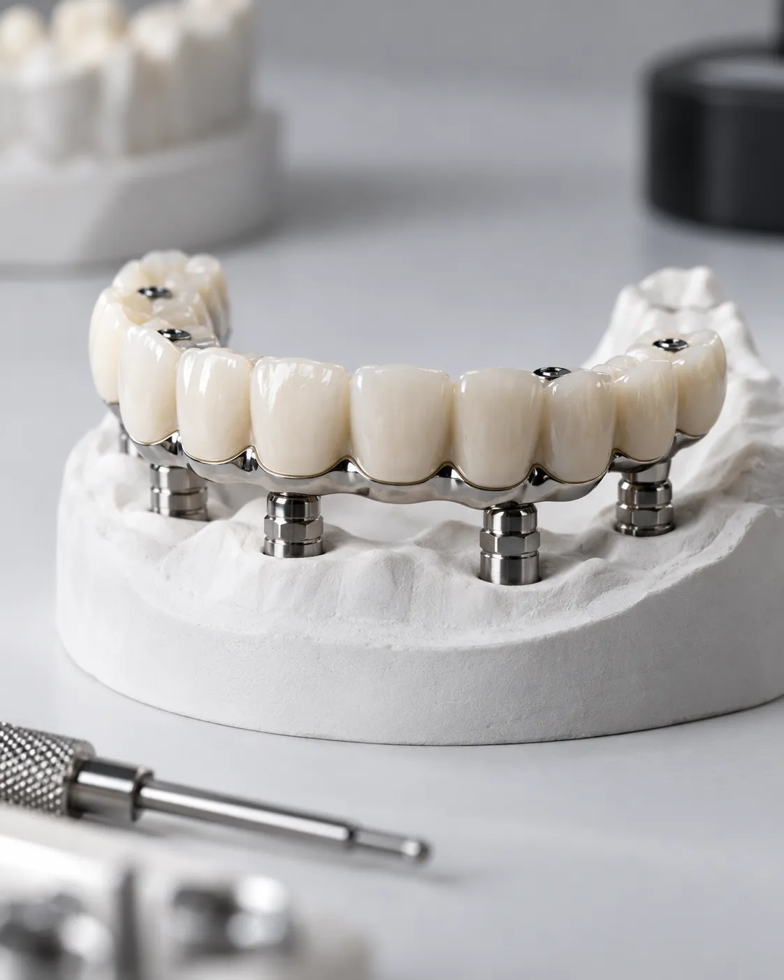 Sobre implantes: trabajo de prótesis dental del laboratorio
